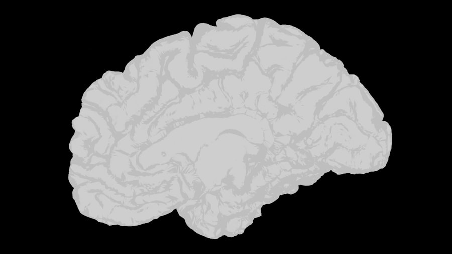 Photo brain improvement supplements