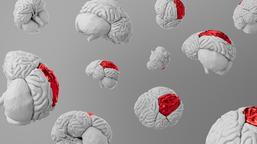 memory training program