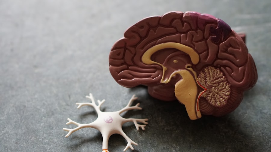 Photo brain training