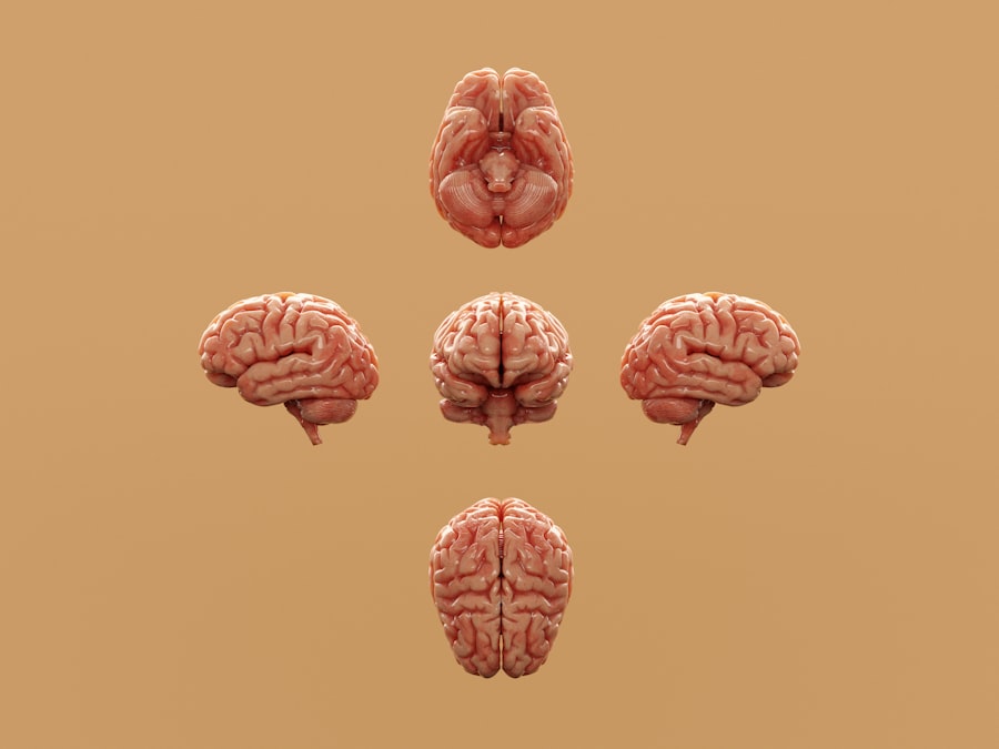 Photo memory loss exercises